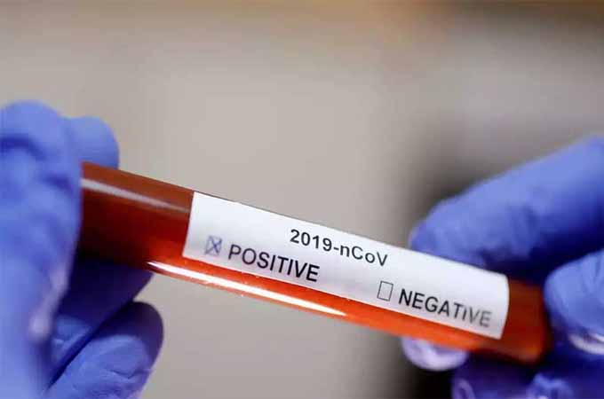 करोनाग्रस्तांच्या तुलनेत करोनामुक्तांचे प्रमाण घसरून ७७.६० टक्यांवर