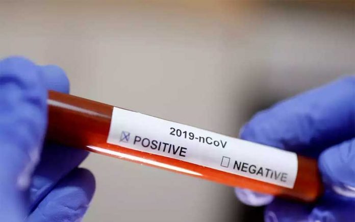 corona-positive