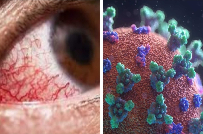 Citizens will Receive Free Treatment for Mucormycosis across Maharashtra