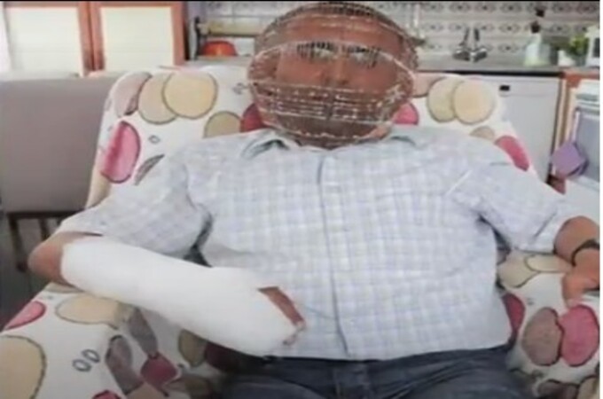 धुम्रपानाची सवय मोडण्यासाठी या व्यक्तीने पिंजऱ्यात बंद केले आपलं डोकं-तोडं, चावी असते पत्नीकडे!