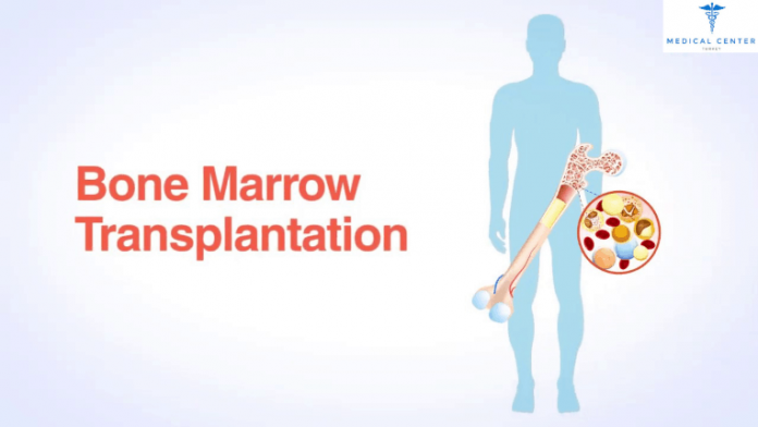bone marrow transplantation