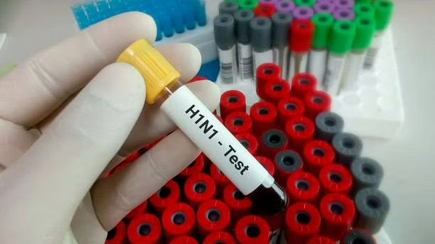 Swine Flu Suggests Its Unsightly Face In Nagpur, 16 Cases Detected