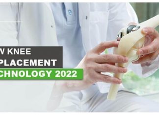 New technology transforming lives of those requiring knee replacement New technology transforming lives of those requiring knee replacement