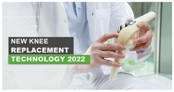 New technology transforming lives of those requiring knee replacement New technology transforming lives of those requiring knee replacement