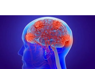 Comatose Patient With Metabolic Encephalopathy Recovers at SMHRC & DBASI Comatose Patient With Metabolic Encephalopathy Recovers at SMHRC & DBASI